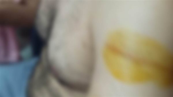 المهندس الضحية