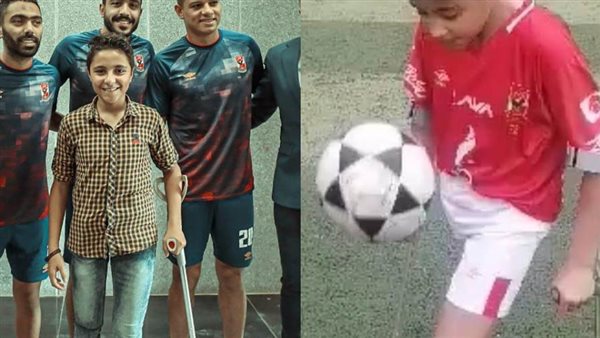 بعد نجاح العملية..