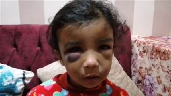 الطفلة رودينا