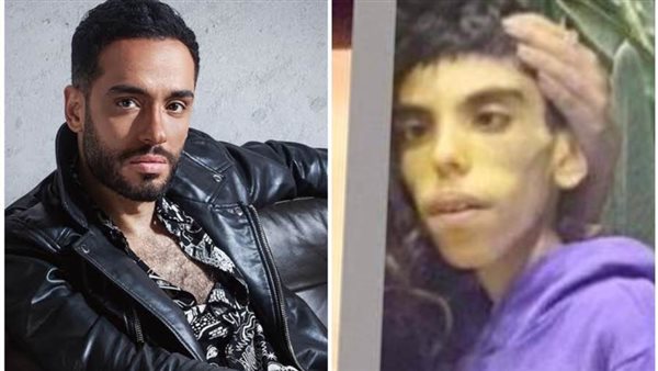 رامي جمال يدعم الطفل