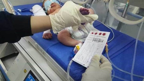 الصحة: فحص 75 ألف