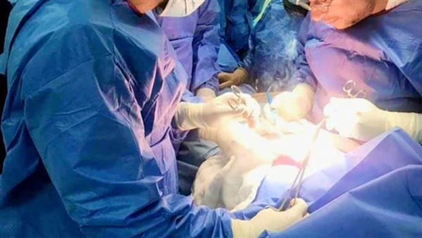 استخراج هاتف محمول