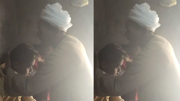 عض الجبهة.. جوده