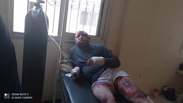 طبيبة تشعل النار