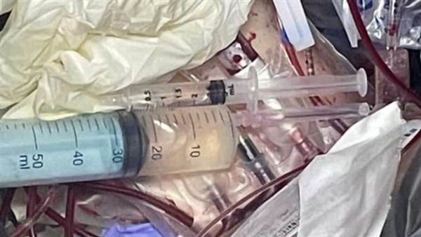 ضبط مركز علاج طبيعي