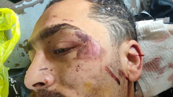 تعالى خد جثة أخوك..