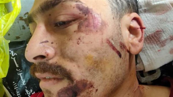 تجديد حبس ٤ متهمين