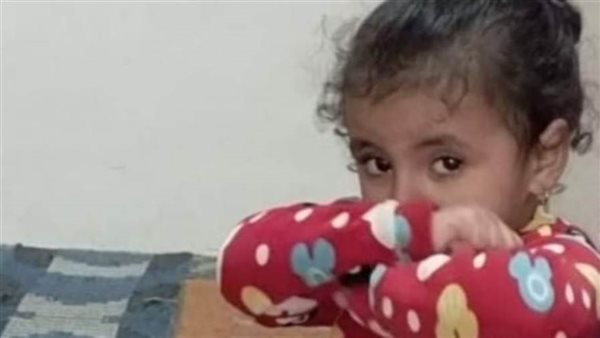 دخلت المستشفى بكسر