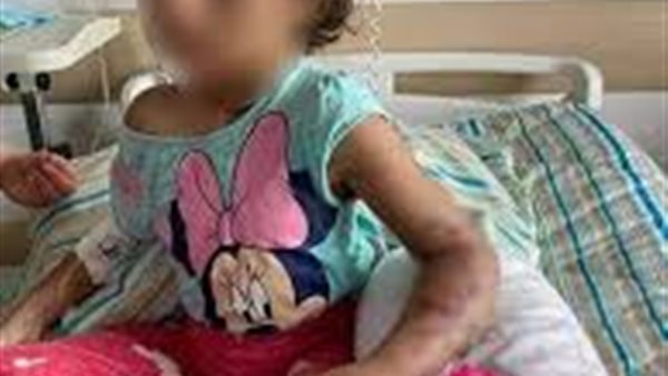 تعذيب طفلة - ارشيفيه