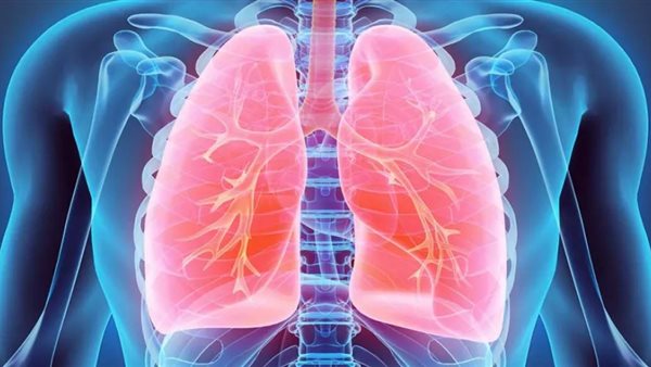 مرض الانسداد الرئوي