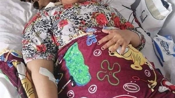 تهشيم وجه معلمة 