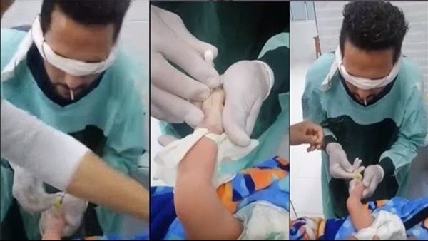 طفل الكانيولا