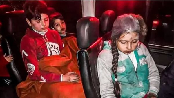 أطفال مصابون جراء