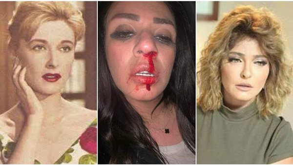 فنانات تعرضن للضرب