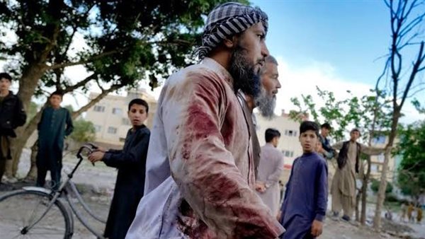 أفغاني ملابسه ملطخة