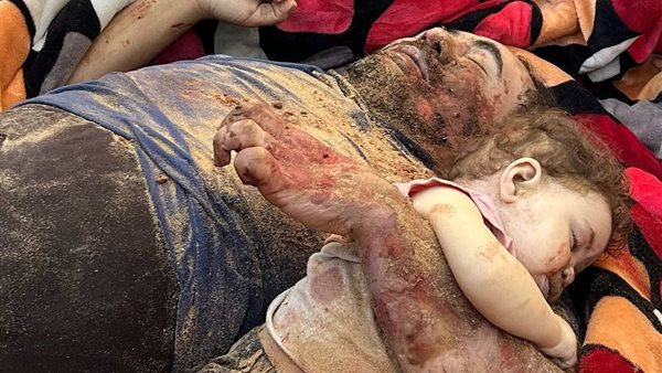 الأب وهو يحتضن طفلته