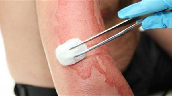 إلقاء مياه نار على