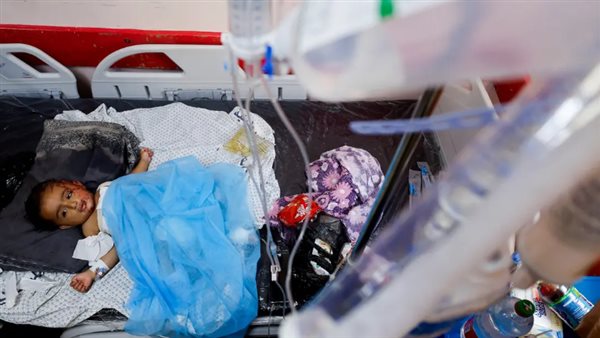 طفل مصاب جراء القصف