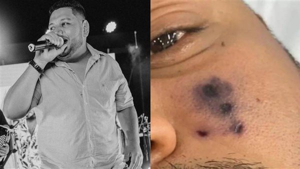 المغني البرازيلي