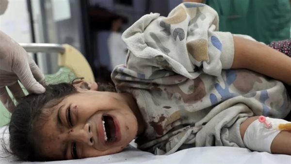 طفلة مصاب جراء القصف