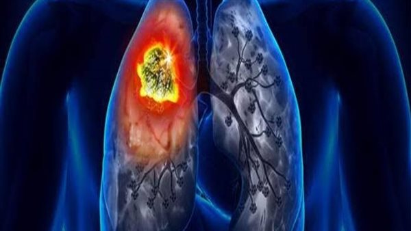 رئيس الصحة العالمية