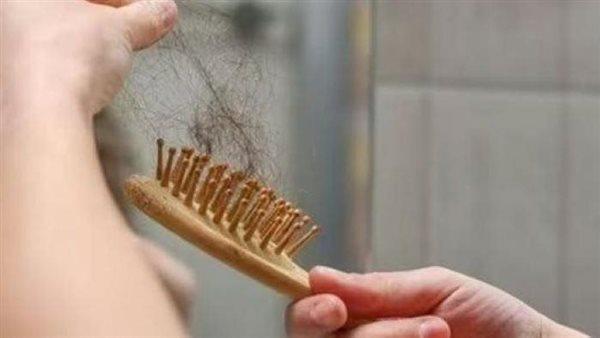 تساقط الشعر 