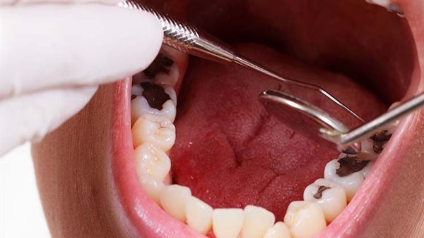 3 مشكلات يسببها السكري