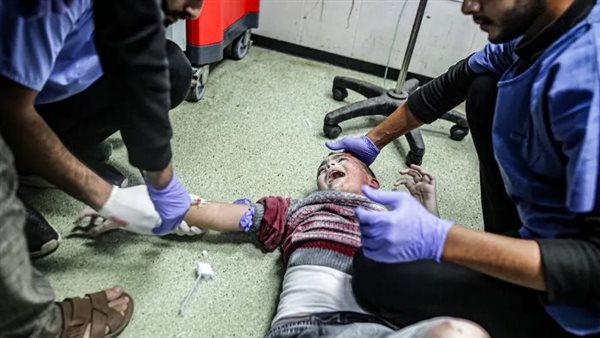 طفل مصاب جراء القصف