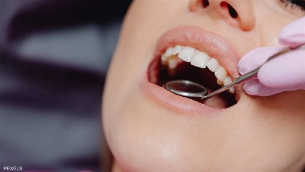 علامات سرطان الفم