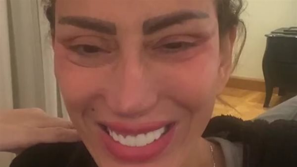 ريهام سعيد بعد عملية