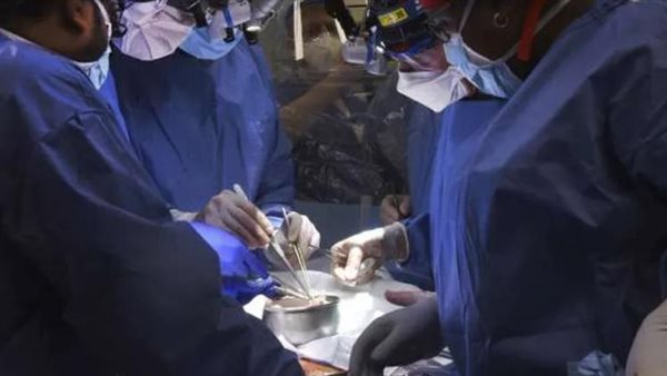 زراعة كلية خنزير