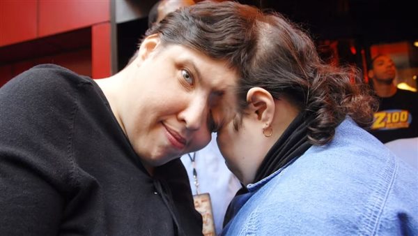 وفاة أكبر توأمين