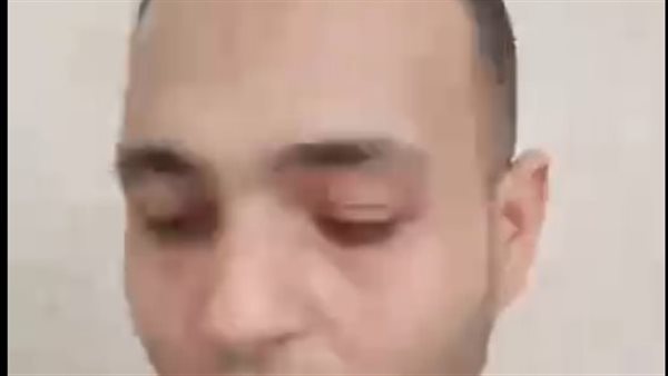 محامي السمكري ضحية