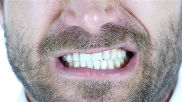 تنظيف الأسنان 