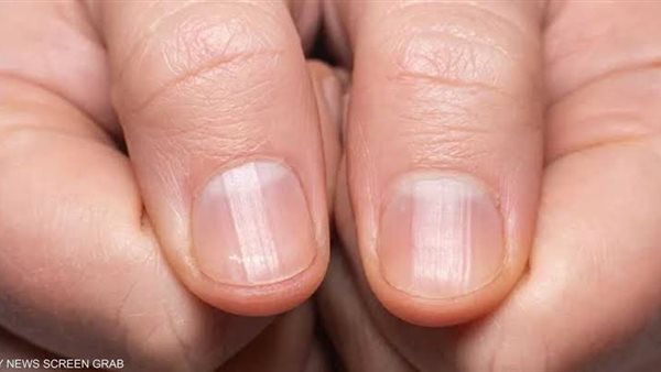 علامة على الاظافر