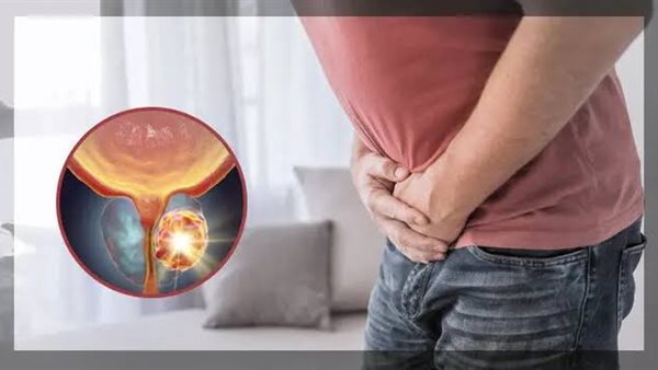 سرطان البروستاتا