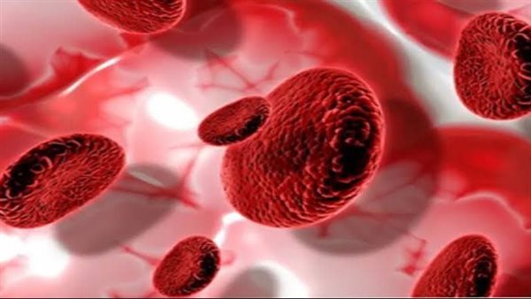 علاج فقر الدم