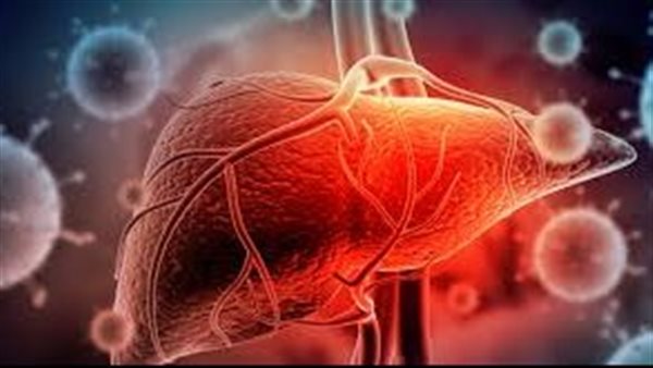 إلتهاب الكبد 