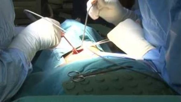 انزلاق غضروفي