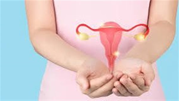 تكيس المبايض 