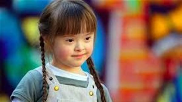 متلازمة داون