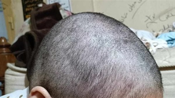 حلق رأس فتاة بسبب