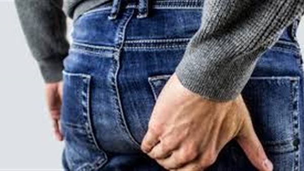 انواع البواسير 