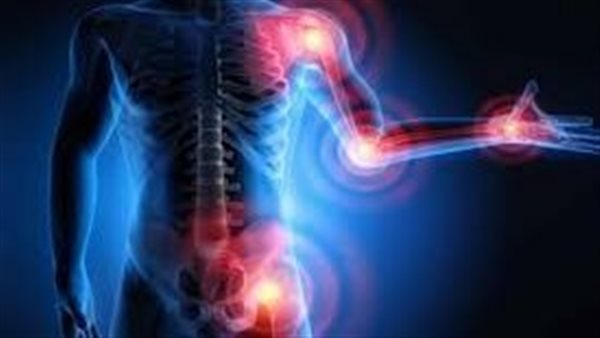 إلتهاب المفاصل 