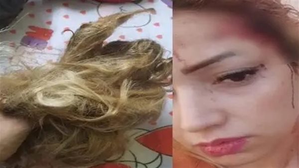 ضحية التيك توك