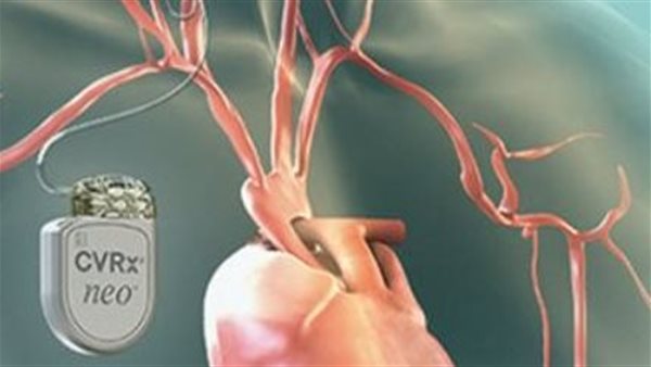 جهاز منظم قلب