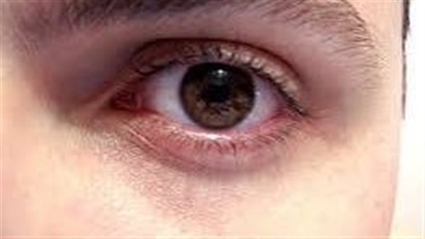 شبكية العين 