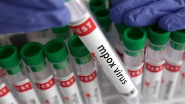 لقاح جدري القرود