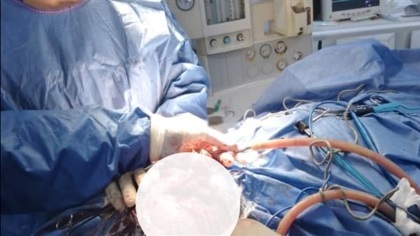 قسم الجراحة يجري