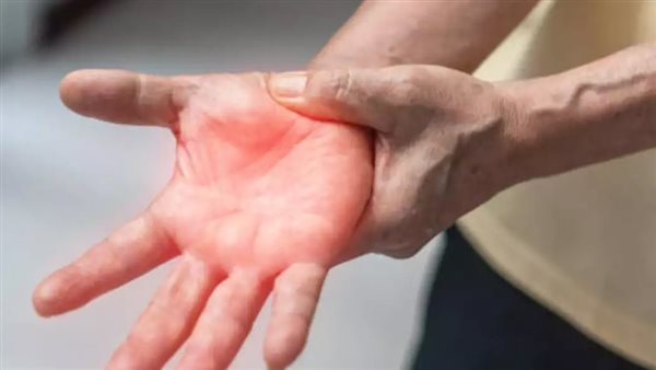 متلازمة غيلان باريه